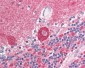 SUMO1 / SMT3 Antibody (N-Terminus)